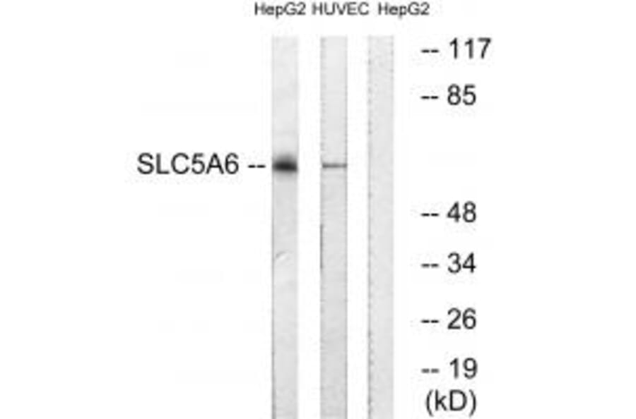 Western blot - SLC5A6 Antibody from Signalway Antibody (35064) - Antibodies.com
