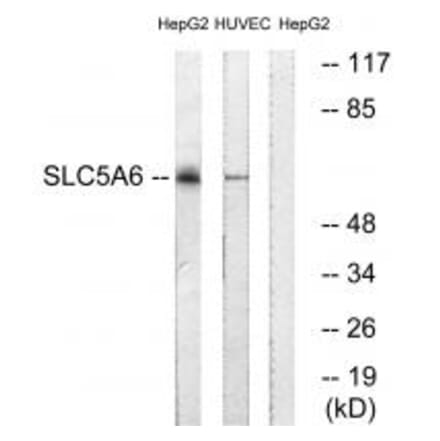 Western blot - SLC5A6 Antibody from Signalway Antibody (35064) - Antibodies.com