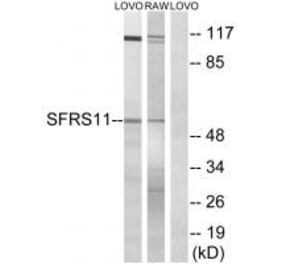 Western blot - SFRS11 Antibody from Signalway Antibody (35073) - Antibodies.com