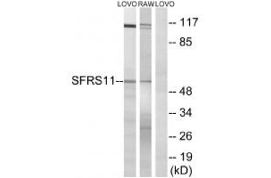 Western blot - SFRS11 Antibody from Signalway Antibody (35073) - Antibodies.com