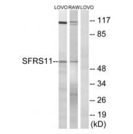 Western blot - SFRS11 Antibody from Signalway Antibody (35073) - Antibodies.com