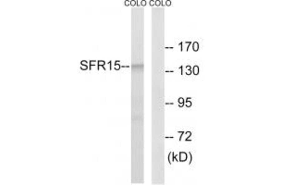 Western blot - SFRS15 Antibody from Signalway Antibody (35074) - Antibodies.com