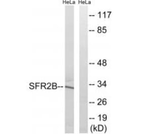 Western blot - SFRS2B Antibody from Signalway Antibody (35075) - Antibodies.com