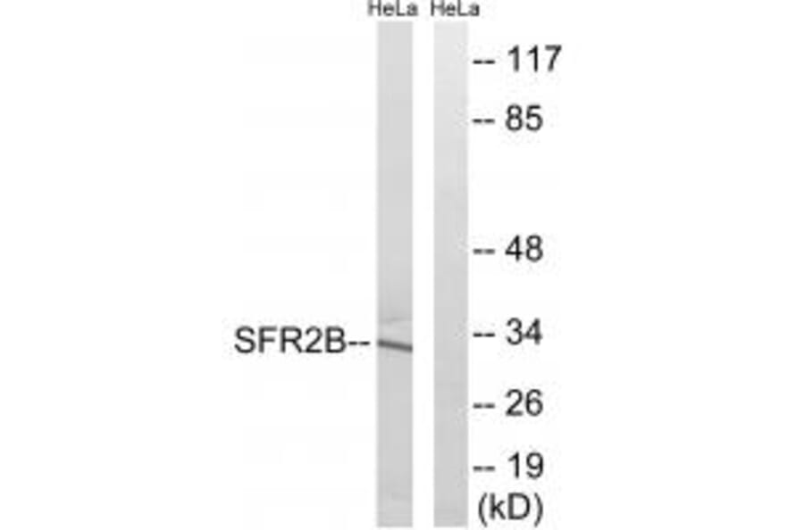 Western blot - SFRS2B Antibody from Signalway Antibody (35075) - Antibodies.com