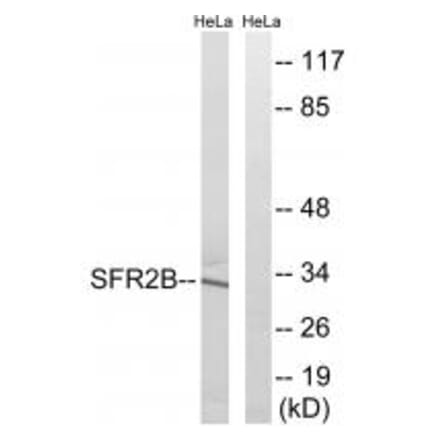 Western blot - SFRS2B Antibody from Signalway Antibody (35075) - Antibodies.com
