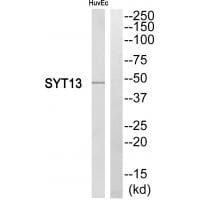 Western blot analysis of extracts from HuvEc cells, using SYT13 antibody #35083.
