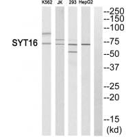 Western blot analysis of extracts from K562 cells, Jurkat cells, 293 cells and HepG2 cells, using SYT16 antibody #35084.