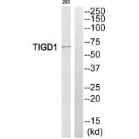 Western blot analysis of extracts from 293 cells, using TIGD1 antibody #35095.