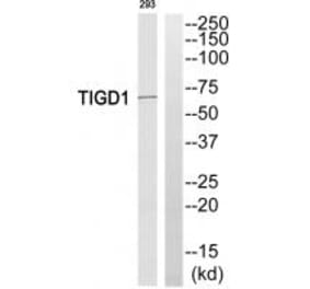 Western blot - TIGD1 Antibody from Signalway Antibody (35095) - Antibodies.com