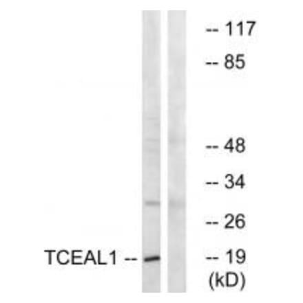 Western blot - TCEAL1 Antibody from Signalway Antibody (35099) - Antibodies.com
