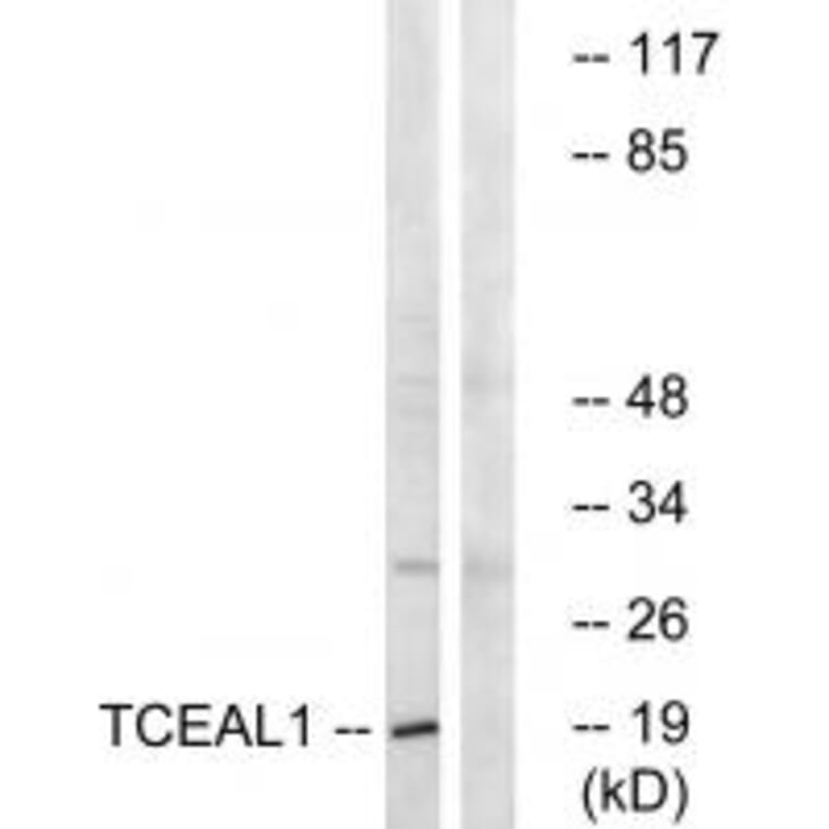 Western blot - TCEAL1 Antibody from Signalway Antibody (35099) - Antibodies.com