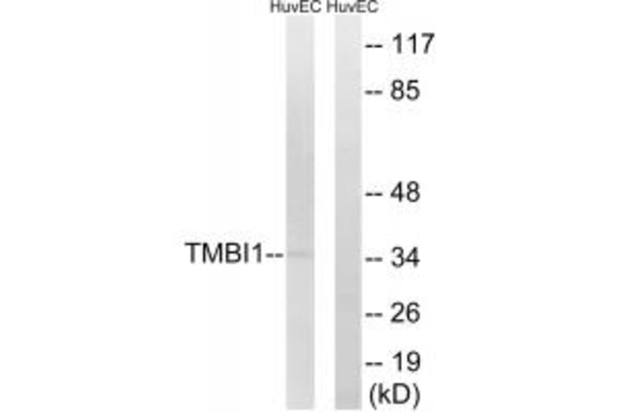 Western blot - TMBIM1 Antibody from Signalway Antibody (35109) - Antibodies.com