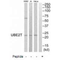 Western blot analysis of extracts from HeLa cells, Jurkat cells and K562 cells, using UBE2T antibody #35133.