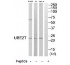 Western blot - UBE2T Antibody from Signalway Antibody (35133) - Antibodies.com