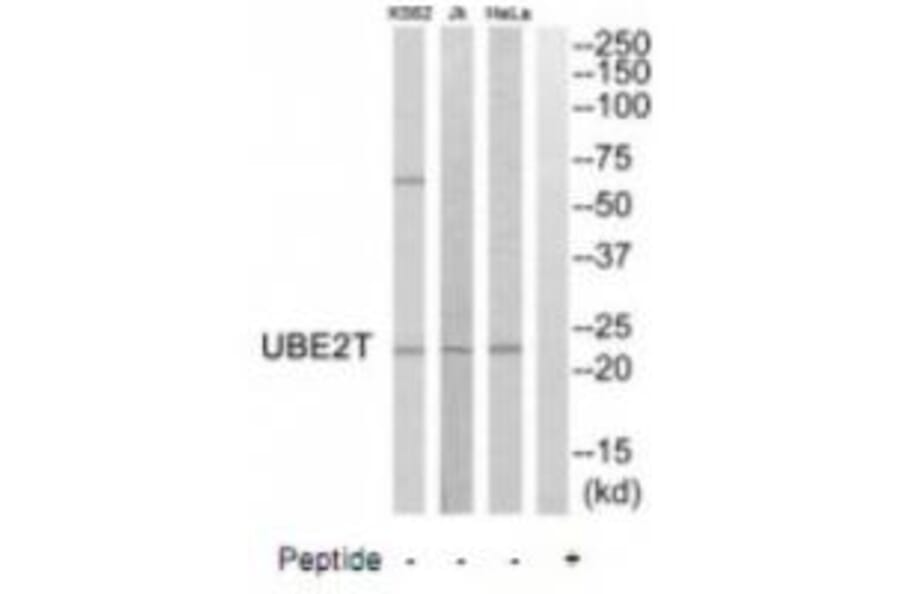 Western blot - UBE2T Antibody from Signalway Antibody (35133) - Antibodies.com