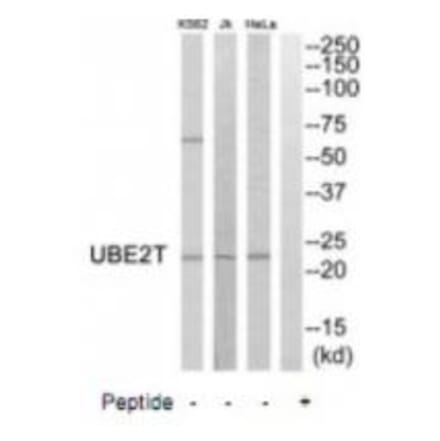 Western blot - UBE2T Antibody from Signalway Antibody (35133) - Antibodies.com