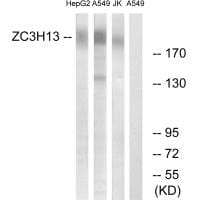 Western blot analysis of extracts from HepG2 cells, A549 cells and Jurkat cells, using ZC3H13 antibody #35153.