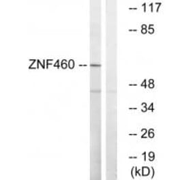 Western blot - ZNF460 Antibody from Signalway Antibody (35158) - Antibodies.com