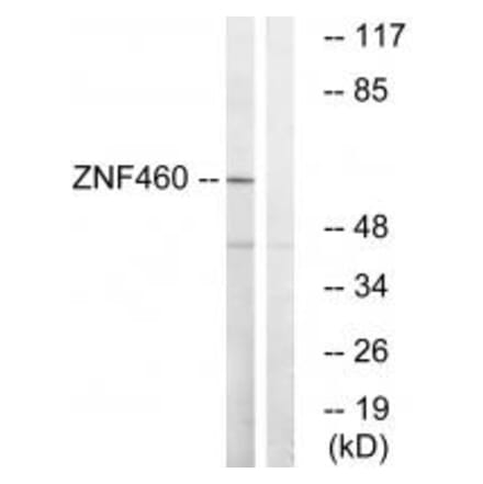 Western blot - ZNF460 Antibody from Signalway Antibody (35158) - Antibodies.com