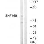 Western blot - ZNF460 Antibody from Signalway Antibody (35158) - Antibodies.com