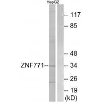 Western blot analysis of extracts from HepG2 cells, using ZNF771 antibody #35159.
