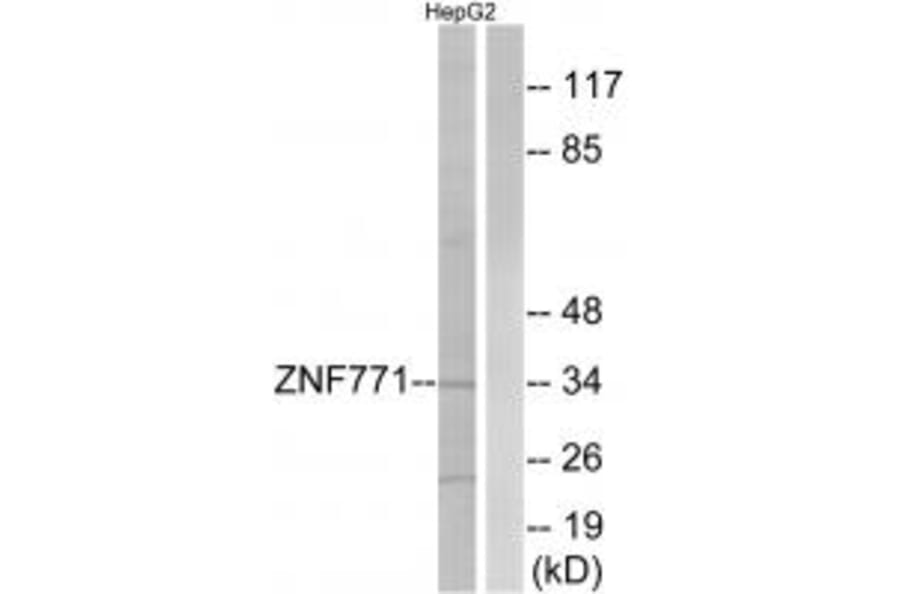 Western blot - ZNF771 Antibody from Signalway Antibody (35159) - Antibodies.com