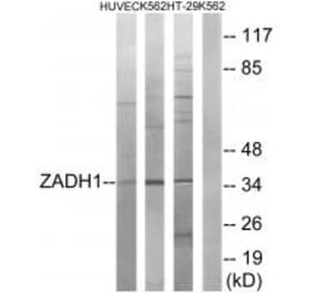 Western blot - ZADH1 Antibody from Signalway Antibody (35164) - Antibodies.com