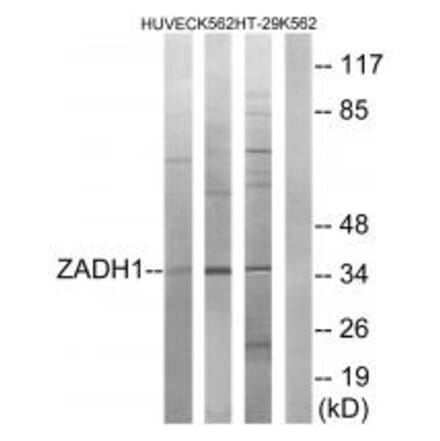 Western blot - ZADH1 Antibody from Signalway Antibody (35164) - Antibodies.com