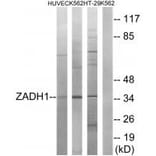 Western blot - ZADH1 Antibody from Signalway Antibody (35164) - Antibodies.com