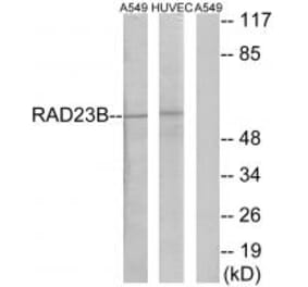 Western blot - RAD23B Antibody from Signalway Antibody (35170) - Antibodies.com