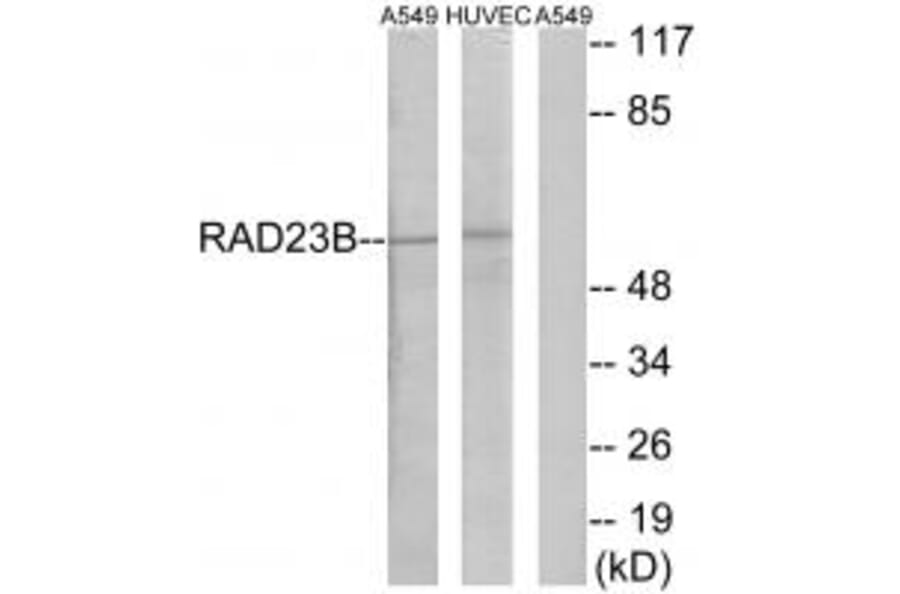 Western blot - RAD23B Antibody from Signalway Antibody (35170) - Antibodies.com
