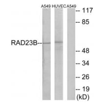 Western blot - RAD23B Antibody from Signalway Antibody (35170) - Antibodies.com