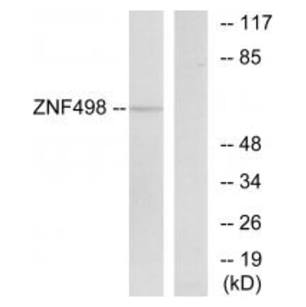 Western blot - ZNF498 Antibody from Signalway Antibody (35172) - Antibodies.com