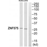 Western blot analysis of extracts from LOVO cells and HUVEC cells, using ZNF575 antibody #35189.