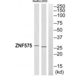 Western blot - ZNF575 Antibody from Signalway Antibody (35189) - Antibodies.com