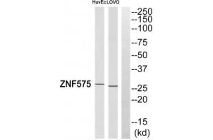 Western blot - ZNF575 Antibody from Signalway Antibody (35189) - Antibodies.com