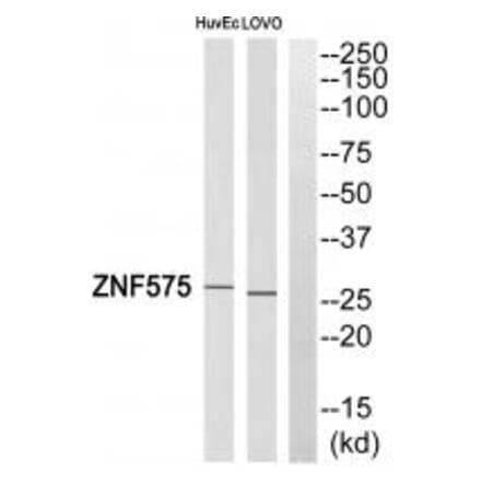 Western blot - ZNF575 Antibody from Signalway Antibody (35189) - Antibodies.com