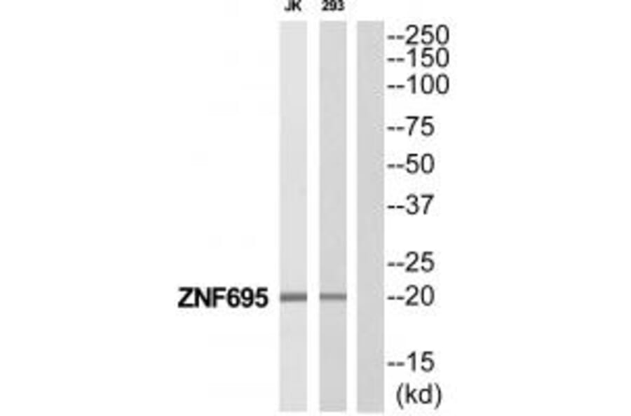 Western blot - ZNF695 Antibody from Signalway Antibody (35191) - Antibodies.com