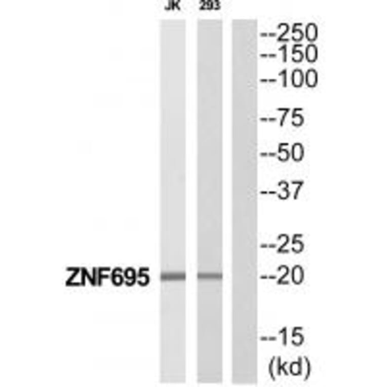 Western blot - ZNF695 Antibody from Signalway Antibody (35191) - Antibodies.com