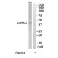 Western blot analysis of extracts from COS7 cells, using ZDHHC2 antibody #35205.