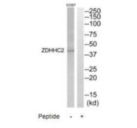 Western blot - ZDHHC2 Antibody from Signalway Antibody (35205) - Antibodies.com