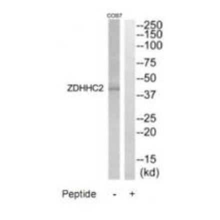 Western blot - ZDHHC2 Antibody from Signalway Antibody (35205) - Antibodies.com