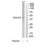 Western blot - ZDHHC2 Antibody from Signalway Antibody (35205) - Antibodies.com