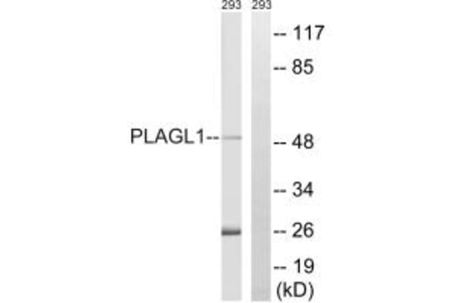 Western blot - PLAGL1 Antibody from Signalway Antibody (35206) - Antibodies.com