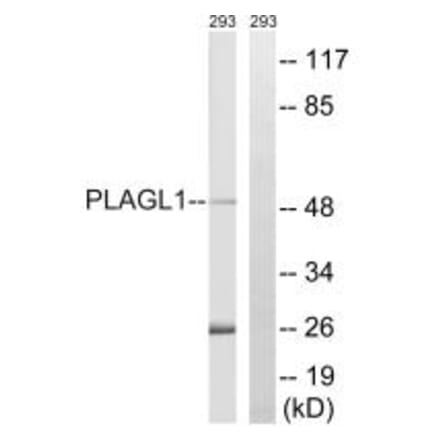 Western blot - PLAGL1 Antibody from Signalway Antibody (35206) - Antibodies.com