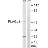 Western blot - PLAGL1 Antibody from Signalway Antibody (35206) - Antibodies.com