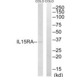 Western blot - IL15RA Antibody from Signalway Antibody (35222) - Antibodies.com