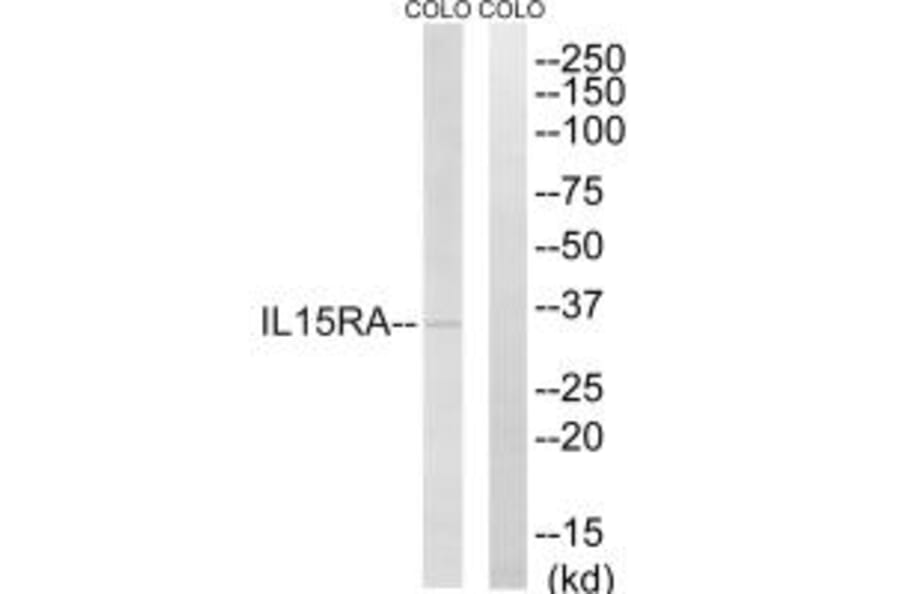 Western blot - IL15RA Antibody from Signalway Antibody (35222) - Antibodies.com