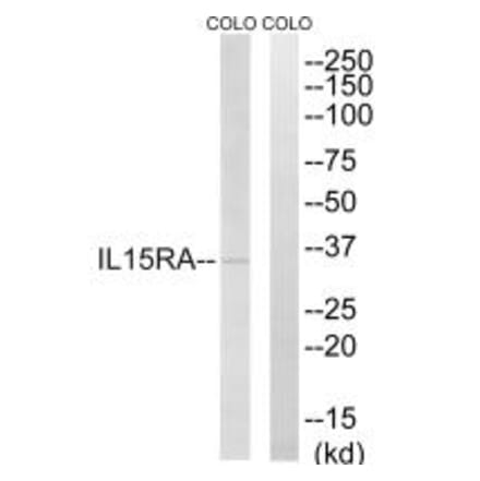 Western blot - IL15RA Antibody from Signalway Antibody (35222) - Antibodies.com