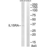 Western blot - IL15RA Antibody from Signalway Antibody (35222) - Antibodies.com
